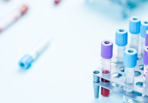 Iespējams pieteikt konkrētu laboratorijas apmeklējuma laiku