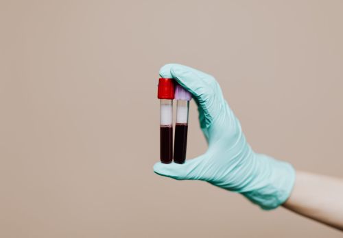 Bauskas slimnīcā turpmāk iespējams veikt QuantiFERON testu