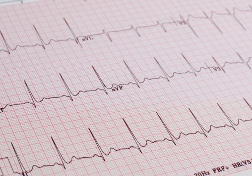 Iespējams pieteikt konkrētu EKG izmeklējuma laiku