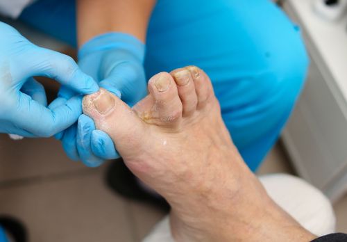 Senioru podoloģijas diena – 7. janvārī Bauskā, 8. janvārī – Iecavā