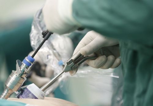 Jaunums Bauskas slimnīcā – žultspūšļa un trūču laparoskopiskās operācijas