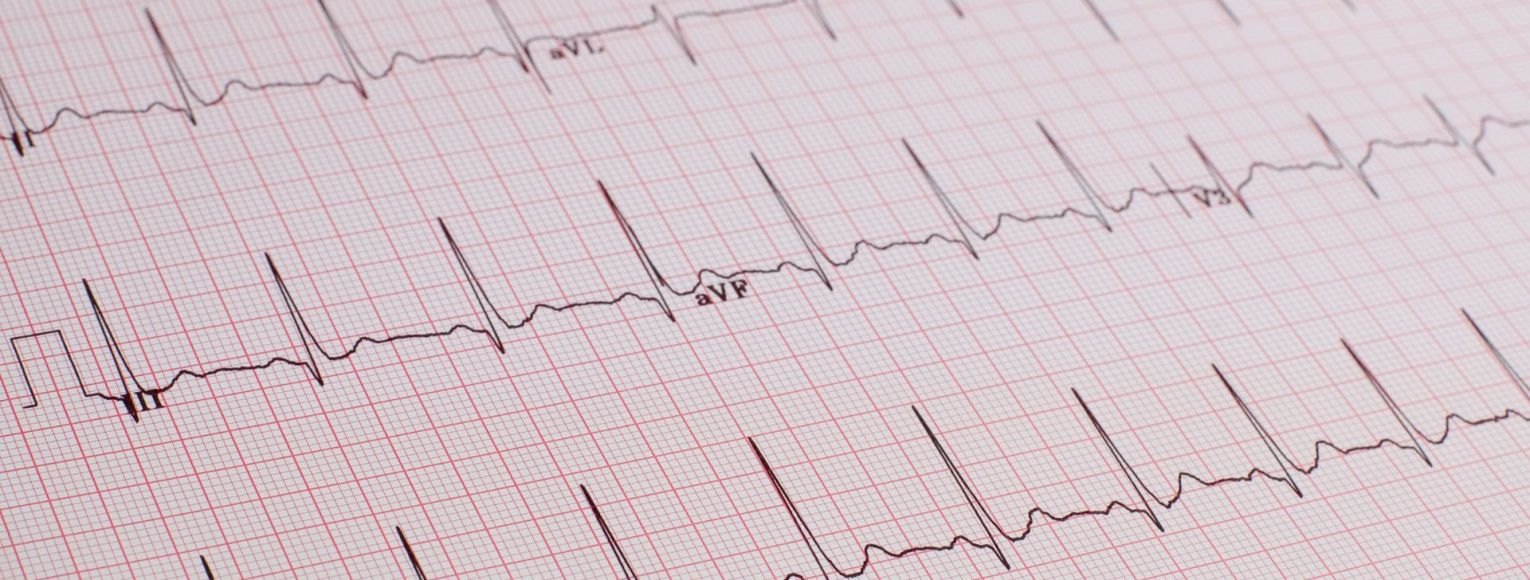 Iespējams pieteikt konkrētu EKG izmeklējuma laiku